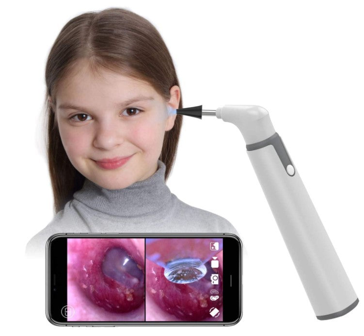 HD720P 6LED WIFI  3.9mm Smart Otoscope Baby Safe Ear Scanning Camera