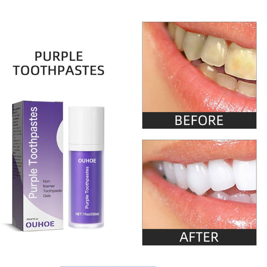 OUHOE Teeth Whitening Toothpaste: Tooth toothpaste, which cleans tooth stains, yellow teeth, fresh and whitening teeth